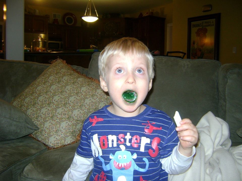 Limit sugary foods-especially if it gives you a green mouth like Dr. Hughes' son. 